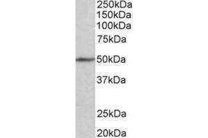 AP31781PU-N CADM1 antibody staining of Mouse Fetal Heart lysate at 1 µg/ml (35 µg protein in RIPA buffer). (CADM1 抗体  (Internal Region))