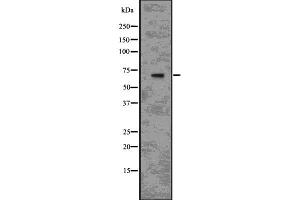 Western blot analysis of IL1R1 using RAW264. (IL1R1 抗体  (C-Term))