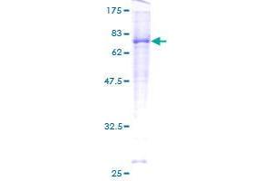 Image no. 1 for Activin A Receptor Type II-Like 1 (ACVRL1) (AA 22-503) protein (GST tag) (ABIN1305819) (ACVRL1 Protein (AA 22-503) (GST tag))