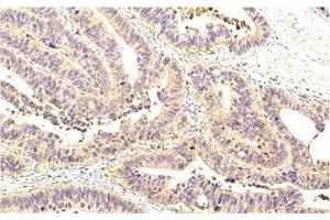 Immunohistochemistry of paraffin-embedded Human colon tissue using STAT1 Monoclonal Antibody at dilution of 1:200. (STAT1 抗体)