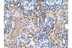 SLC46A3 antibody was used for immunohistochemistry at a concentration of 4-8 ug/ml to stain Epithelial cells of renal tubule (arrows) in Human Kidney. (SLC46A3 抗体  (N-Term))