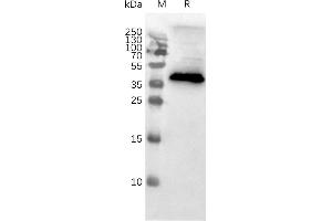 Western blot of MNPs (CCR8 蛋白)