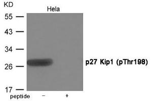 Western blot analysis of extracts from Hela cells using p27 Kip1 (Phospho-Thr198) Antibody. (CDKN1B 抗体  (pThr198))