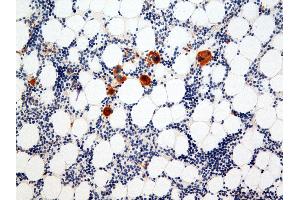 Immunohistochemistry (IHC) image for anti-Integrin Alpha2b (CD41) antibody (ABIN108423) (Integrin Alpha2b 抗体)