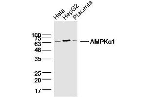 Lane1: HeLa lysates Lane 2: HepG2 lysates Lane 3: mouse placenta lysates probed with AMPK alpha-1 Polyclonal Antibody, Unconjugated  at 1:300 dilution and 4˚C overnight incubation. (PRKAA1 抗体)