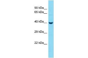 Host:  Rabbit  Target Name:  Pcmtd2  Sample Type:  Mouse Liver lysates  Antibody Dilution:  1. (PCMTD2 抗体  (C-Term))