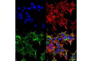 Immunocytochemistry/Immunofluorescence analysis using Mouse Anti-GFAP R416WT Monoclonal Antibody, Clone S206B-9 . (GFAP 抗体  (AA 411-422) (Biotin))