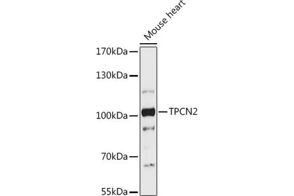 TPCN2 抗体  (AA 11-85)