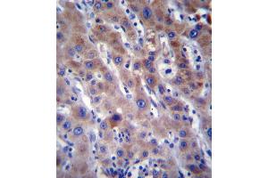 FADS2 Antibody immunohistochemistry analysis in formalin fixed and paraffin embedded human liver tissue followed by peroxidase conjugation of the secondary antibody and DAB staining. (FADS2 抗体  (N-Term))