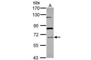 Image no. 1 for anti-Acyl-CoA Oxidase 1, Palmitoyl (ACOX1) (Internal Region) antibody (ABIN1495970) (ACOX1 抗体  (Internal Region))