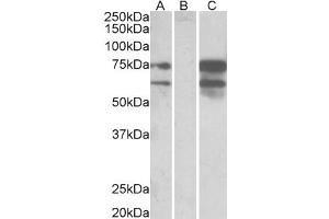 Western Blotting (WB) image for anti-Neurexin 1 (NRXN1) antibody (ABIN5887202) (Neurexin 1 抗体)