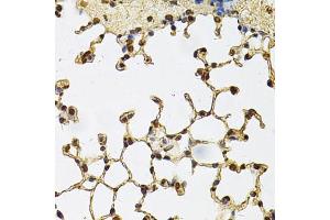 Immunohistochemistry of paraffin-embedded mouse lung using IFI16 Antibody (ABIN6291165) at dilution of 1:100 (40x lens). (IFI16 抗体)