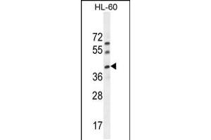 Western blot analysis in HL-60 cell line lysates (35ug/lane). (C17orf59 抗体  (AA 186-215))