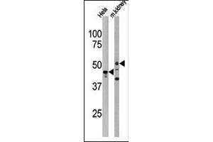 Western blot analysis of anti-PSKH1 Antibody (N-term) in Hela cell line lysate and mouse kidney tissue lysate (35ug/lane). (PSKH1 抗体  (N-Term))