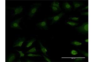 Immunofluorescence of purified MaxPab antibody to PSMB7 on HeLa cell. (PSMB7 抗体  (AA 1-277))