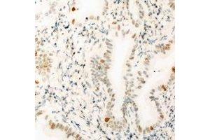 Immunohistochemical analysis of THOC1 staining in mouse kidney formalin fixed paraffin embedded tissue section. (THOC1 抗体)