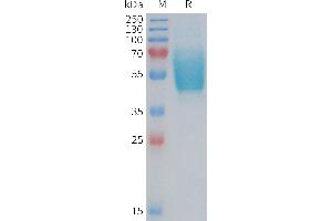 CALCRL Protein (AA 23-140) (mFc Tag)