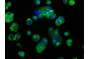 Immunofluorescence staining of MCF-7 cells with ABIN7156352 at 1:400, counter-stained with DAPI. (IGF1R 抗体  (AA 763-931))