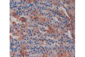 Used in DAB staining on fromalin fixed paraffin- embedded Kidney tissue (MTUS1 抗体  (AA 1020-1210))