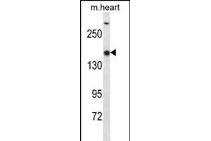 SET1B Antibody (C-term) (ABIN656346 and ABIN2845645) western blot analysis in mouse heart tissue lysates (35 μg/lane). (SETD1B 抗体  (C-Term))