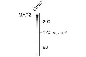 Image no. 1 for anti-Microtubule-Associated Protein 2 (MAP2) antibody (ABIN372661) (MAP2 抗体)