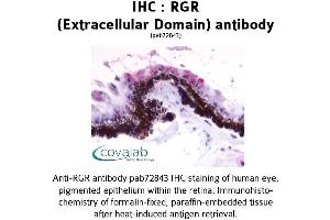 Image no. 1 for anti-Retinal G Protein Coupled Receptor (RGR) (2nd Extracellular Domain) antibody (ABIN1738847) (RGR 抗体  (2nd Extracellular Domain))