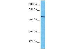 Host:  Mouse  Target Name:  YY1  Sample Tissue:  Mouse Brain  Antibody Dilution:  1ug/ml (YY1 抗体  (Middle Region))