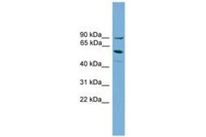 Image no. 1 for anti-Arachidonate 15-Lipoxygenase B (ALOX15B) (AA 401-450) antibody (ABIN6745484) (ALOX15B 抗体  (AA 401-450))