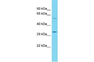 Host: Rabbit Target Name: CDKL4 Sample Type: Fetal Heart lysates Antibody Dilution: 1. (CDKL4 抗体  (N-Term))