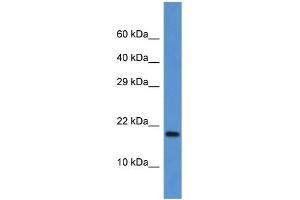 WB Suggested Anti-Fxn Antibody Titration: 1. (Frataxin 抗体  (C-Term))