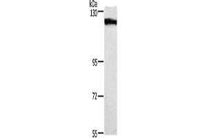 Western Blotting (WB) image for anti-Desmoglein 1 (DSG1) antibody (ABIN2432944) (Desmoglein 1 抗体)