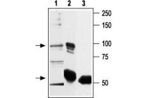 Immunoprecipitation of rat basophilic leukemia (RBL) lysate: - 1. (TRPV2 抗体  (C-Term, Intracellular))