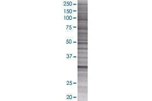 Western Blotting (WB) image for TST 293T Cell Transient Overexpression Lysate(Denatured) (ABIN1333801)