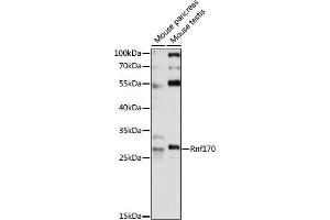 Western blot analysis of extracts of various cell lines, using Rnf170 antibody (ABIN7270065) at 1:1000 dilution. (RNF170 抗体  (AA 1-200))