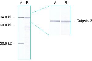 Western Blot: analysis of human skeletal muscle showing detection of calpain 3 proteins. (Calpain 抗体  (AA 1-19))