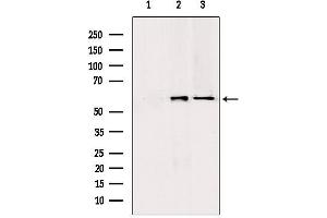 Western blot analysis of extracts from various samples, using PKLR antibody. (PKLR 抗体  (Internal Region))