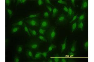 Immunofluorescence (IF) image for anti-SMAD, Mothers Against DPP Homolog 2 (SMAD2) (AA 181-280) antibody (ABIN517619)
