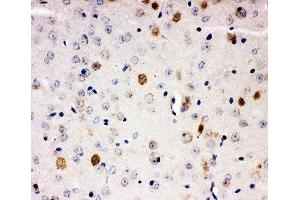 IHC-P: AHR antibody testing of mouse brain tissue (Aryl Hydrocarbon Receptor 抗体  (C-Term))