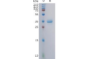 GPRC5A Protein (AA 1-33) (mFc Tag)