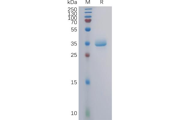 GPRC5A Protein (AA 1-33) (mFc Tag)