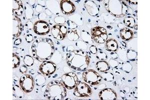 Immunohistochemical staining of paraffin-embedded Kidney tissue using anti-PSMC3 mouse monoclonal antibody. (PSMC3 抗体)