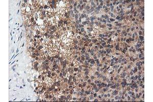 Immunohistochemical staining of paraffin-embedded Human breast tissue using anti-ADIPOQ mouse monoclonal antibody. (ADIPOQ 抗体  (AA 19-244))