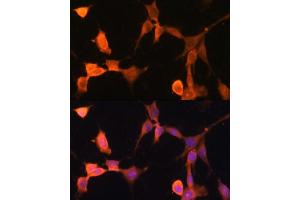 Immunofluorescence analysis of NIH-3T3 cells using CACYBP antibody  at dilution of 1:100. (CACYBP 抗体  (AA 1-228))