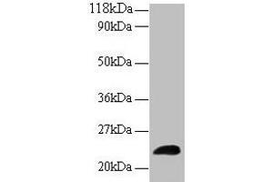 Western blot All lanes: LCN2 antibody at 2 μg/mL + Human positive serum Secondary Goat polyclonal to rabbit IgG at 1/15000 dilution Predicted band size: 23 kDa Observed band size: 23 kDa (Lipocalin 2 抗体  (AA 1-198))