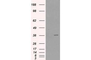 HEK293T cells were transfected with the pCMV6-ENTRY control (Left lane) or pCMV6-ENTRY SORD (Right lane) cDNA for 48 hrs and lysed. (SORD 抗体)