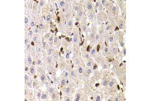 Immunohistochemistry of paraffin-embedded human liver injury using SPN antibody. (CD43 抗体)