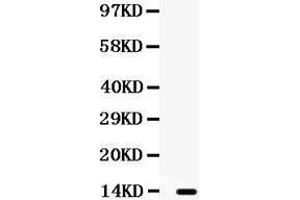 Observed bind size: 13KD (XCL1 抗体  (AA 22-114))