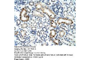 Rabbit Anti-ZESR2 Antibody  Paraffin Embedded Tissue: Human Kidney Cellular Data: Epithelial cells of renal tubule Antibody Concentration: 4. (ZRSR2 抗体  (C-Term))