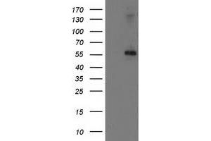 HEK293T cells were transfected with the pCMV6-ENTRY control (Left lane) or pCMV6-ENTRY PPM1B (Right lane) cDNA for 48 hrs and lysed. (PPM1B 抗体)