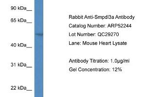 Western Blotting (WB) image for anti-Sphingomyelin phosphodiesterase, Acid-Like 3A (SMPDL3A) (N-Term) antibody (ABIN2784841) (SMPDL3A 抗体  (N-Term))